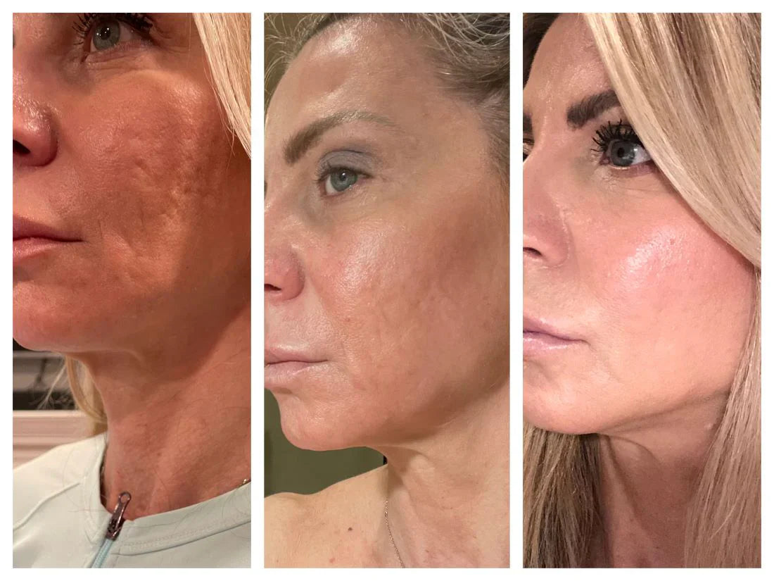 Ritual Over Routine: How LED Therapy Fits into a Holistic Skincare Lifestyle